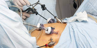 Laparoscopic & Hysteroscopic Surgeries